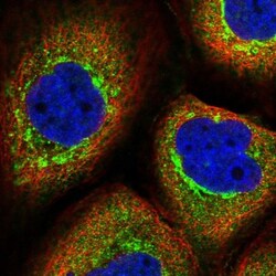 TMCO7 Antibody, Novus Biologicals 0.1mL; Unlabeled:Antibodies, Polyclonal
